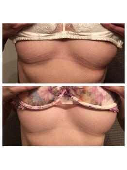 ブドワール(BOUDOIR)/下胸ふっくらまんまるバストに