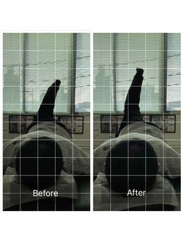 ナオル整体 長崎諫早院(NAORU整体)/長崎諫早/整体・矯正