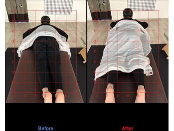 ストレチックス 近江八幡店/BeforeAfter