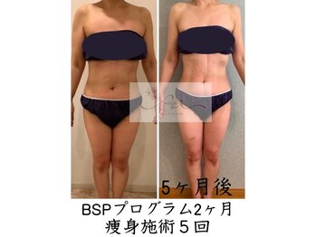 アイ エステサロン(Ai)/【50代】マイナス8キログラム♪