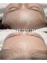 チュルリ 新町店(Chururi)/フェイスワックス/顔脱毛