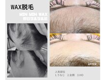 うなじ・顔・ブラジリアン(VIO)ワックス脱毛が人気♪