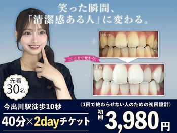 ホワイトニングショップ 今出川店(WHITENING SHOP)