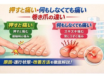 巻き爪じゅん 千葉駅前店/その巻き爪危険？2種類の違い