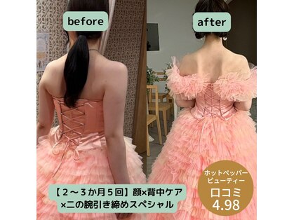 オンリ(ONRI)の写真