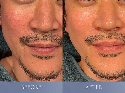 カズキ ハギワラ(Kazuki Hagiwara)の写真