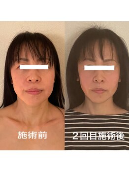 ラ アクサル(la.akthar)/小顔 骨格矯正 整体