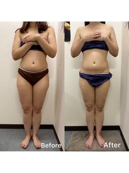 ルクール(Le Couer)/３０代３ヶ月後