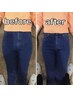 【産後太り専門】-5キロ以上希望！骨盤矯正＋ダイエットカウンセリング
