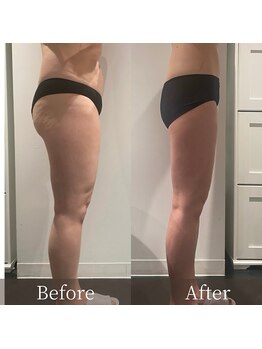 インフィニーズ(INFINEEZ)/カスタマイズ120分痩身40代