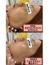 シロ(SHIRO)/EMSとモデリングパック