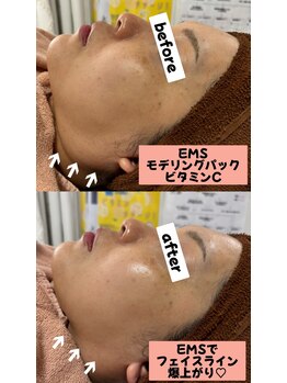 シロ(SHIRO)/EMSとモデリングパック