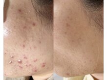 エヌ(N)の雰囲気（正しいホームケアと継続したサロンケアで揺るがないお肌へ◎）