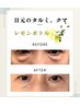 【切らないクマ取り】脂肪分解レモンボトルで切らないクマ取り!お試し価格