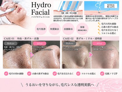 ドール(doll)の写真