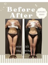 コハク エビス(KOHAKU EBISU)/全身コース5か月の効果写真