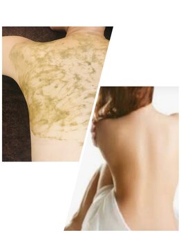 クレア 国際通りカーゴス店(CREA)/人気♪ハーブピーリング