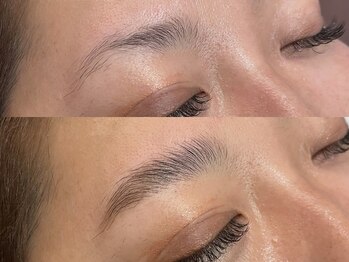 ビクシー(vixxcy)/レディースビフォーアフター