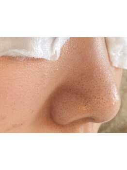 毛穴ケアをしたい