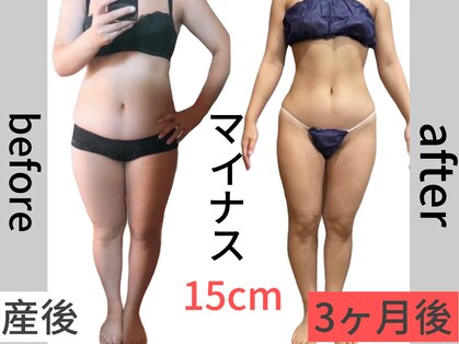 アーク(ARC)の写真