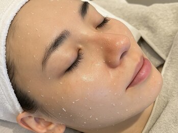 エピベル(Epibelle)の写真/《ソフトピーリングで肌底からハリを与えてたるみを改善！》継続で予防◎お肌への負担が少ないのも嬉しい♪