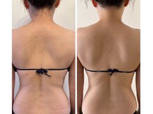 ワイスタイル(Y_STYLE)の雰囲気（大人気な滝汗痩身☆温熱ドーム→ハイパーラジオ波→セルケア）