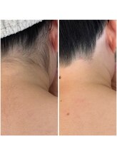 ザ ビードットデザイン(The b. design)/ビフォーアフター