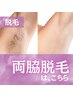 【都度払い脱毛】両ワキ脱毛 1回1,650円