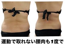 ジール(ZEAL)/痩身/ダイエット　初回のお客様