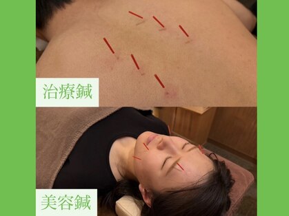 門司駅やわらぎ鍼灸整骨院の写真