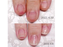 ネイルサロン アイリー(Nail salon Irie)の雰囲気（【ジェルを塗らずに自爪育成】3ヶ月で縦長美爪へ☆）