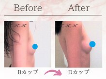 エムエムエム 表参道Luxeサロン(M.M.M)/【バストアップ例】　B→Dカップ