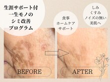 完全オーダーメイドのメニューで最短改善◎