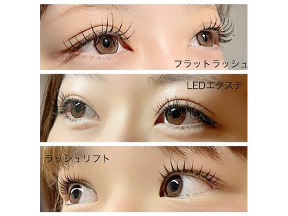 リジェネ(Regene)の写真