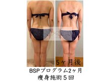 アイ エステサロン(Ai)/【50代】諦めかけていた体型…