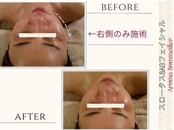 アロマ ソメイエ(Aroma Sommeiller)/スロータスSAGフェイシャル