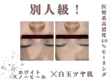 エステティック レイビス 銀座店(RAYVIS)/