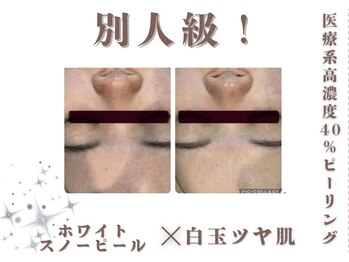 エステティック レイビス 銀座店(RAYVIS)/