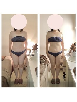 アクア エステティコ 亀有(ACQUA estetico)/上半身 3ヶ月変化 40代