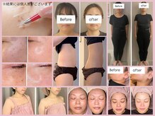 ボーテドリッシュ(Beaute de Riche)の雰囲気(結果出しにとことこんこだわり豊富なメニューを取り揃えています)