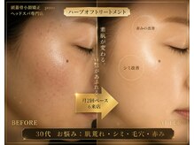 ポノ 甲府本店(pono)/ハーブオフピーリング