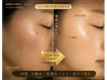 ポノ 甲府本店(pono)/ハーブオフピーリング