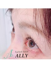 アリー(ALLY)/
