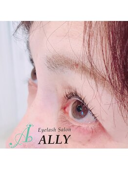 アリー(ALLY)/
