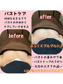 エルア(2 elua)/バストケア