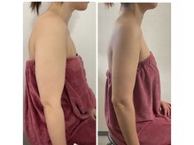 ブリランテ(Brillante)/体験→継続6回目beforeafter