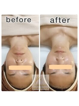 筋線美術コルギ 目黒店/