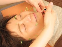 住吉鍼灸院アネックス/美容鍼