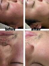 サロンデュヒャーク 志木駅前店(salon du ひゃーく)/男性もオススメです♪