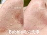 【黒ずみ毛穴スッキリ！】メンズフェイシャルBubble毛穴洗浄(小鼻)￥3,900
